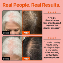 Hair Growth Serum with Massage Brush Applicator – Thickening & Hair Regrowth Scalp Treatment for Fuller, Stronger Hair